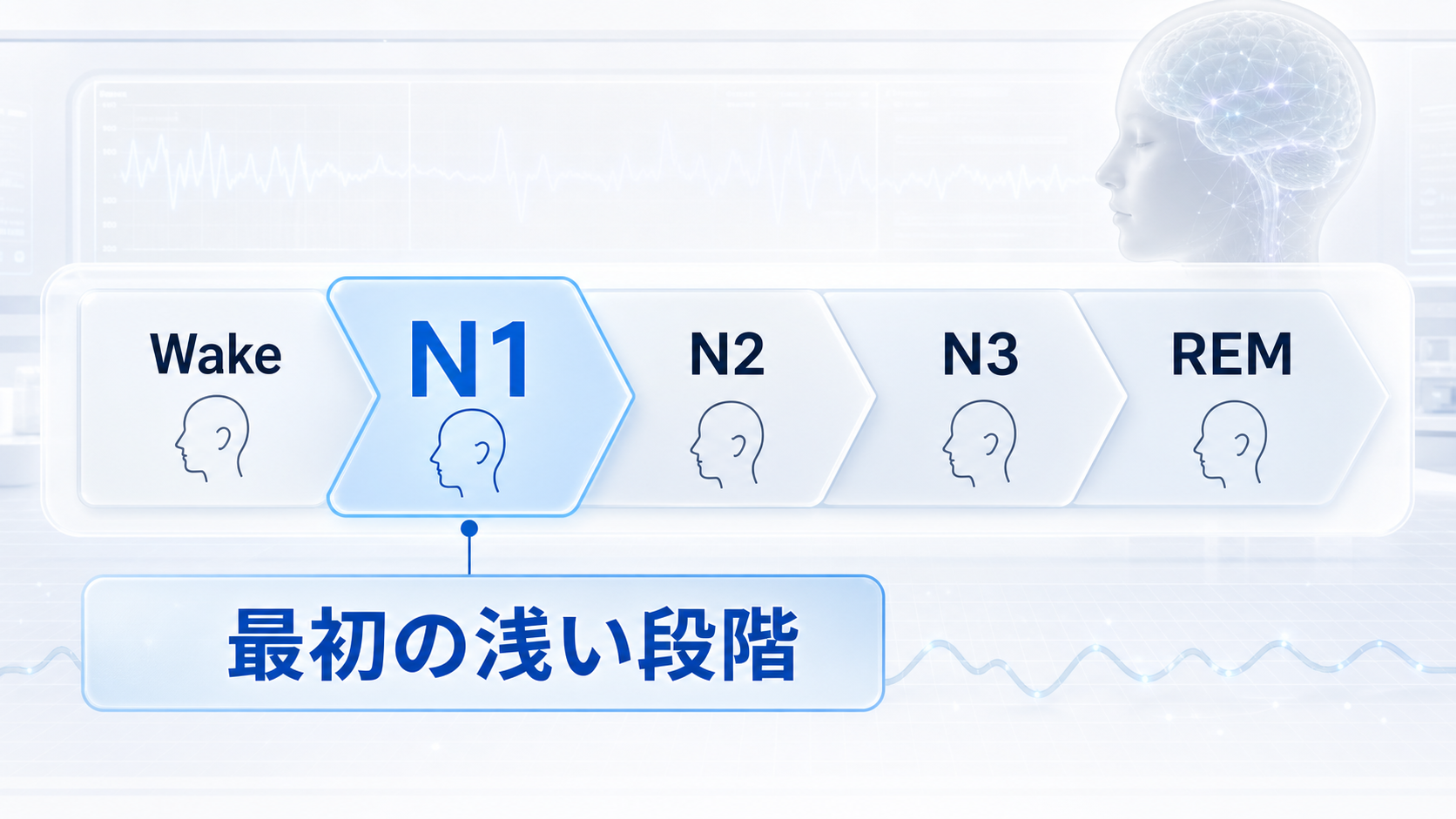 Wake、N1、N2、N3、REMの睡眠段階の中でN1が最初の浅い段階だと示す図解